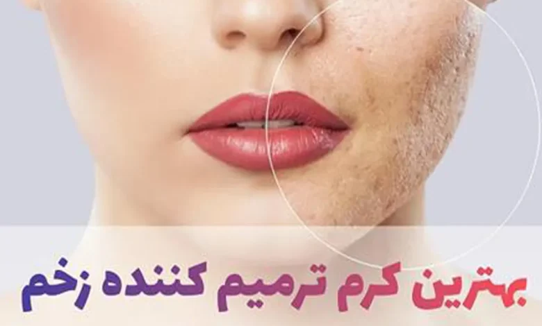 بهترین کرم ترمیم کننده بعد از لیزر خال