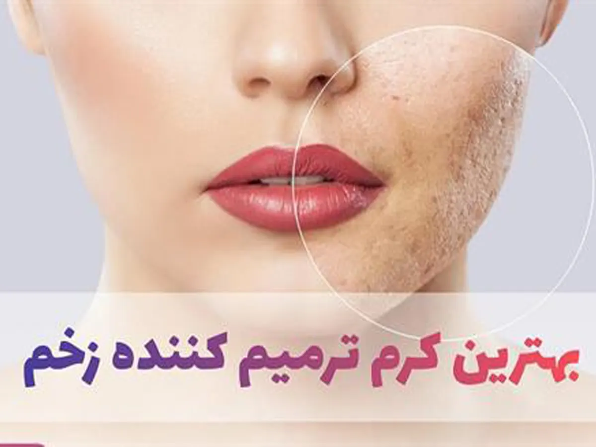 بهترین کرم ترمیم کننده بعد از لیزر خال