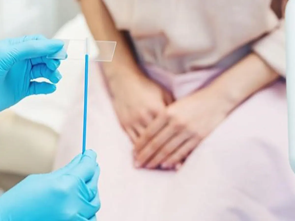 بهترین زمان انجام تست پاپ اسمیر