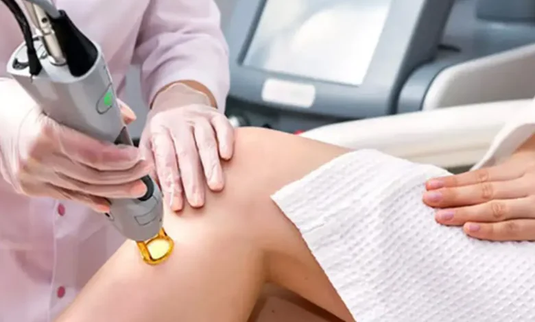 لیزر در کلینیک ارکید