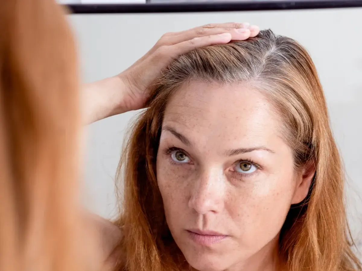 چه غذاهایی در رژیم غذایی برای جلوگیری از سفید شدن مو مؤثرند؟